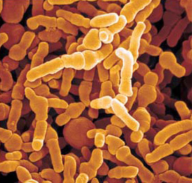 bifidobacterium-infantis-probiotics